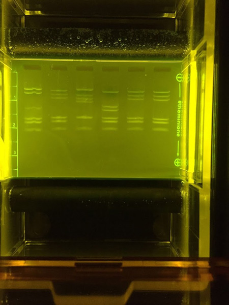 DNA results